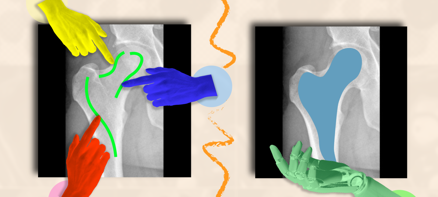 A fast and flexible approach to help doctors annotate medical scans